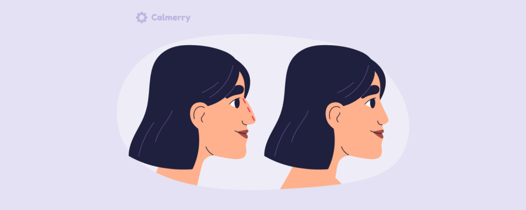 Plastic surgery addiction